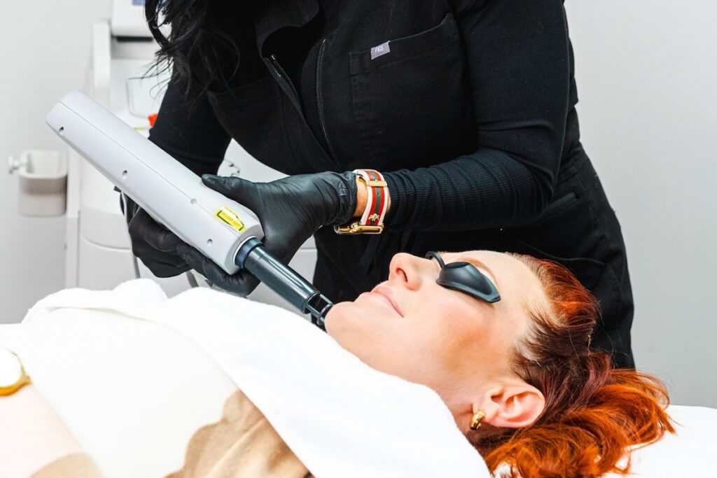 Close-up of a provider treating a patient with the fractional Erbium laser. The La Bella team uses this laser for sun damage treatment.