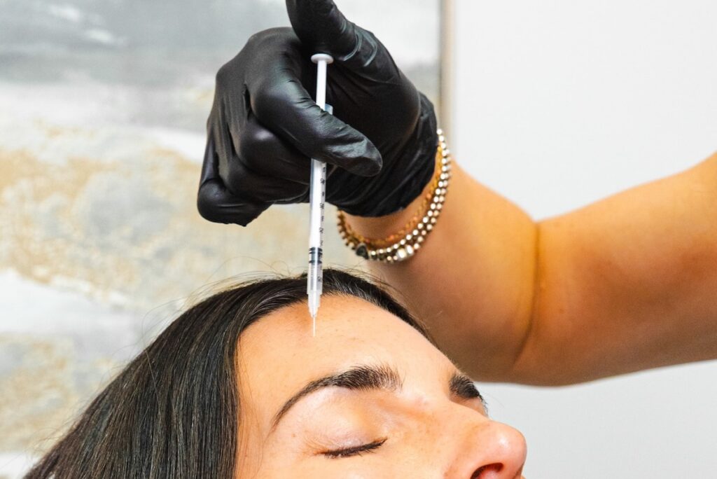Close-up of a gloved provider placing preventive Botox in a patient's forehead.